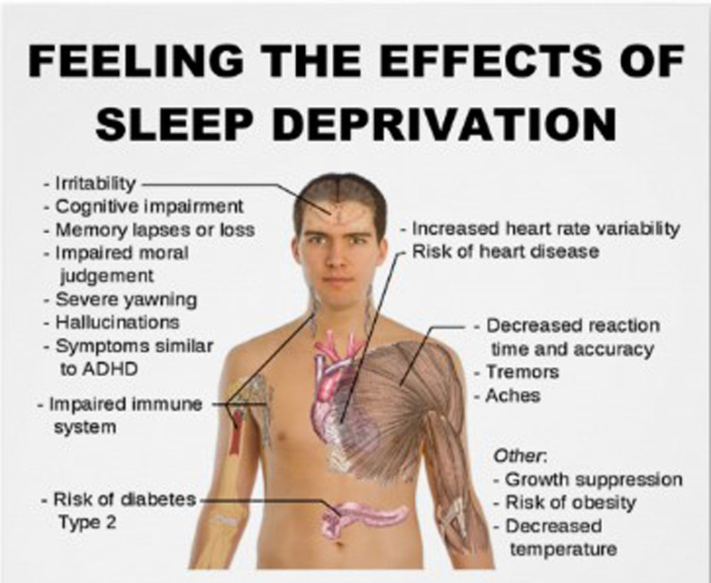 Sleep Deprivation Adults 59
